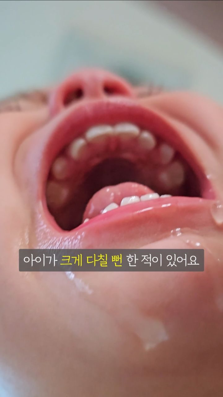 μ½μλ₯΄ μμ€ λ―ΈλλΌλ°©μ§ λ§€νΈ + νΈν
μ건