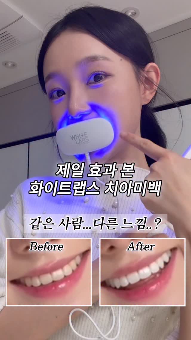 화이트랩스 치아미백