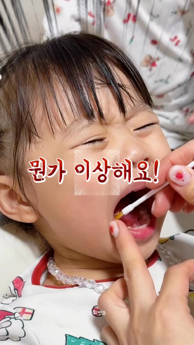 셀프 불소도포제