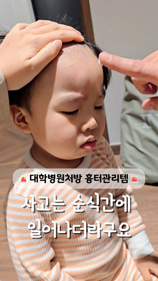 리메스카 흉터스틱