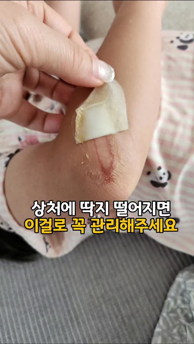 프로실플러스 흉터관리 스틱