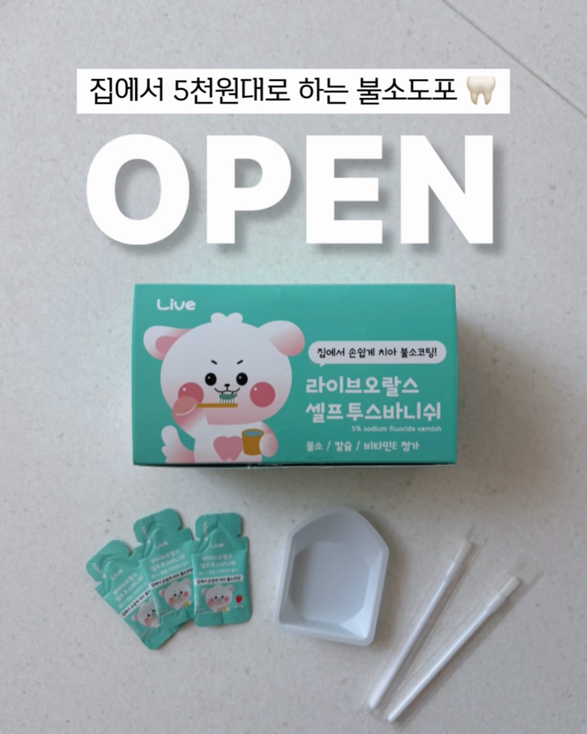 치아 불소코팅